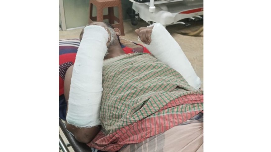 ভোলার মনপুরায় যুবলীগ নেতা মনিরের হাত-পা ভেঙে দিল দুর্বৃত্তরা