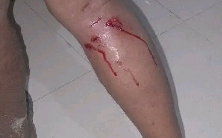 শেরপুরের নকলায় পাগলা কুকুরের তান্ডব