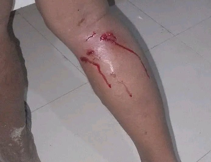 শেরপুরের নকলায় পাগলা কুকুরের তান্ডব