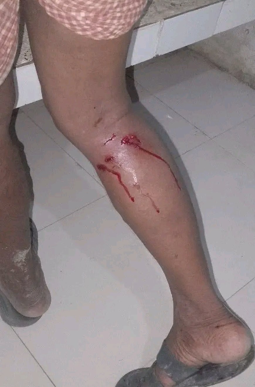 শেরপুরের নকলায় পাগলা কুকুরের তান্ডব