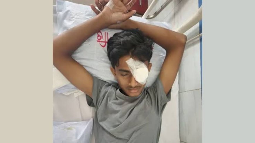 এনসিপির কর্মসূচিতে হামলায় চিরতরে আলো হারাল ছাত্রশক্তি নেতা আলিফের এক চোখ