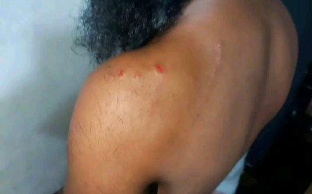 শেরপুরের নকলায় ইসলামী আন্দোলনের দায়িত্বশীলের উপর ছাত্রদলের হামলা