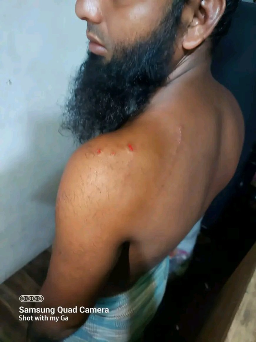 শেরপুরের নকলায় ইসলামী আন্দোলনের দায়িত্বশীলের উপর ছাত্রদলের হামলা